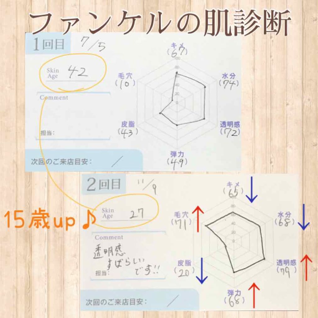ハトムギ化粧水(ナチュリエ スキンコンディショナー R )/ナチュリエ/化粧水を使ったクチコミ（2枚目）