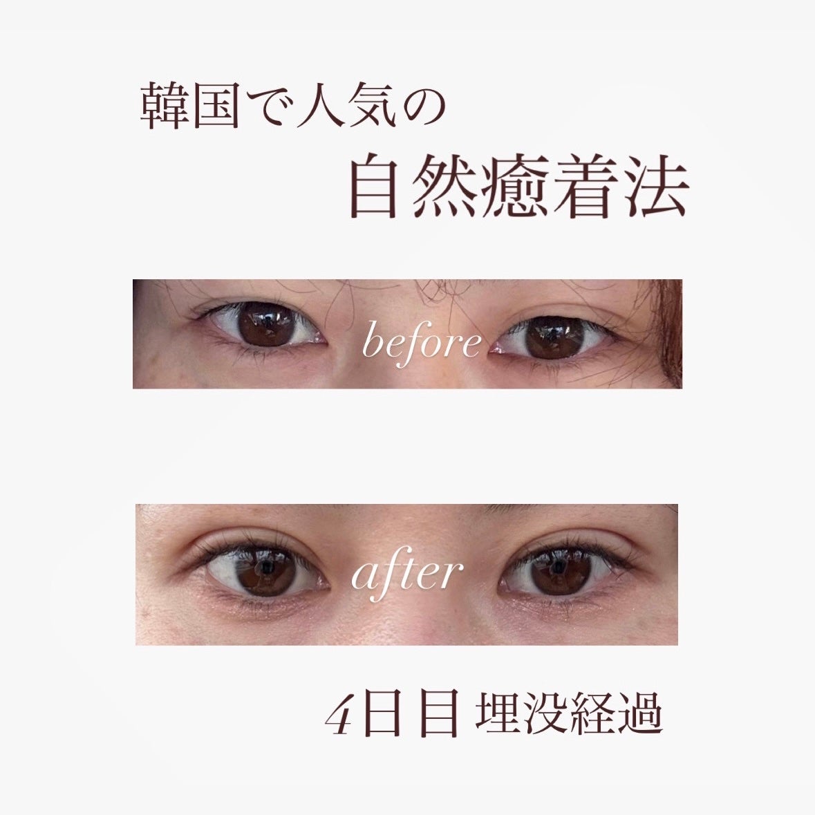 アイトーク/アイトーク/二重まぶた用アイテムを使ったクチコミ(1枚目)