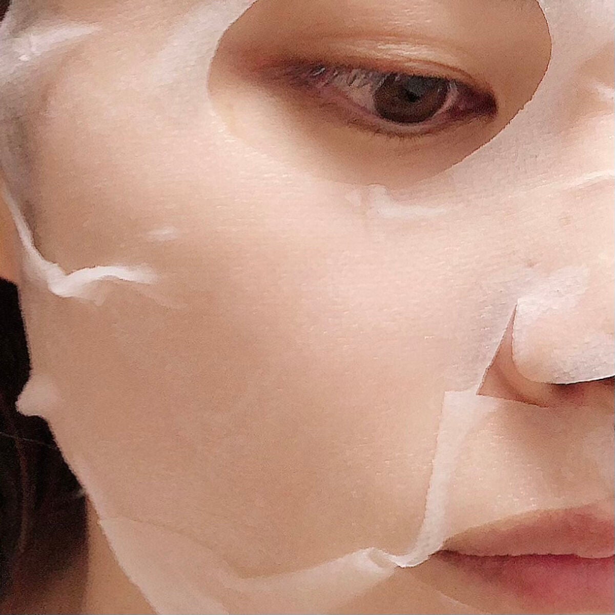 スキントラブルケア マスク/アルージェ/シートマスク・パックを使ったクチコミ(5枚目)