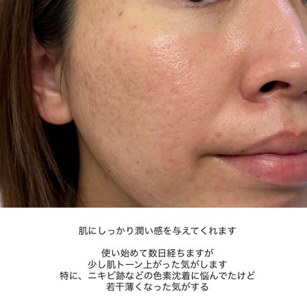 TX-Cream/Dr.Melaxin/フェイスクリームを使ったクチコミ(5枚目)