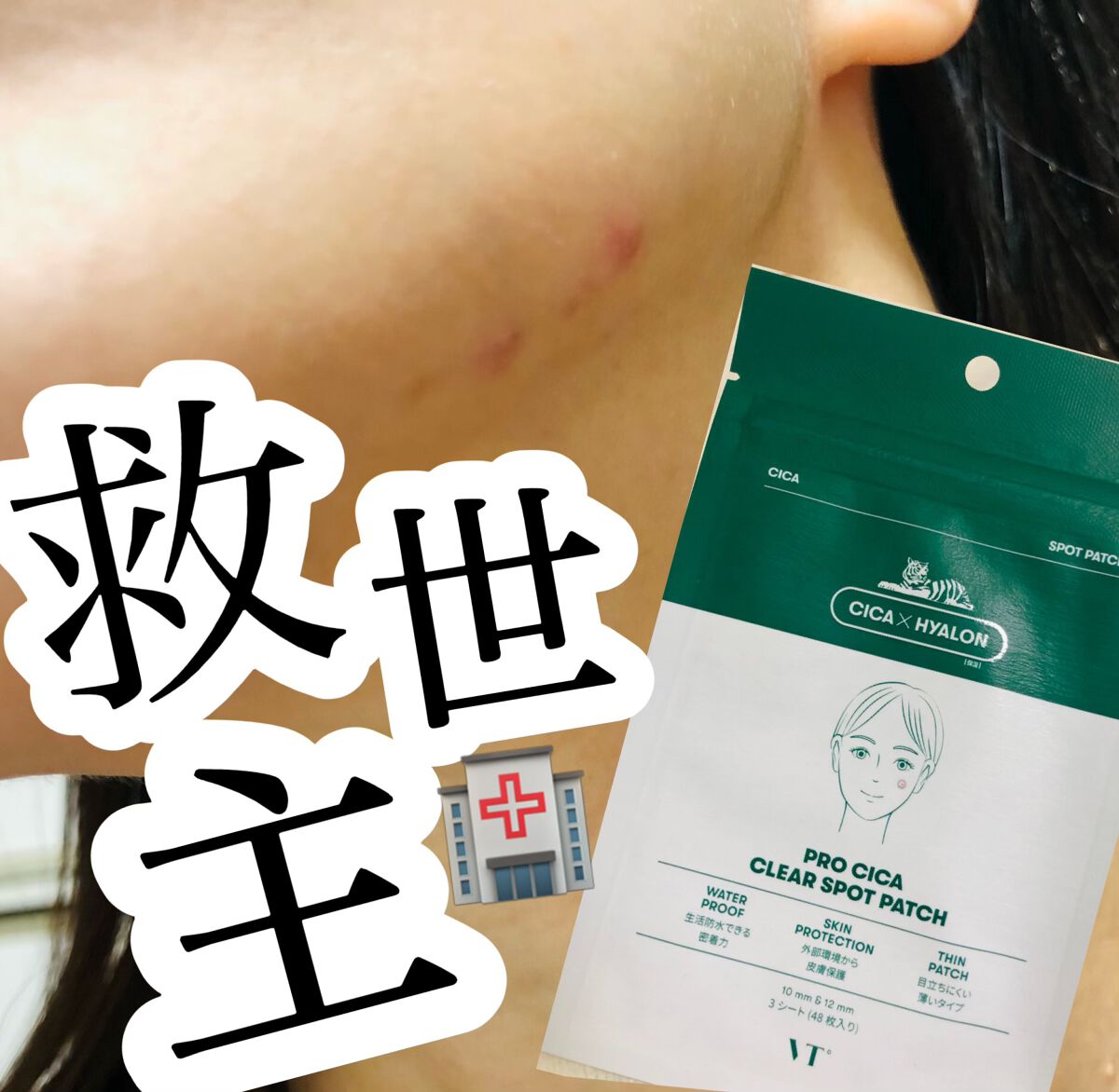 プロCICA クリアスポットパッチ/VT/その他スキンケアを使ったクチコミ(1枚目)