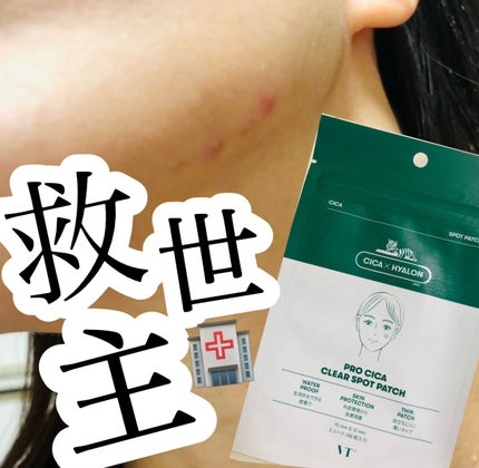 プロCICA クリアスポットパッチ/VT/その他スキンケアを使ったクチコミ(1枚目)
