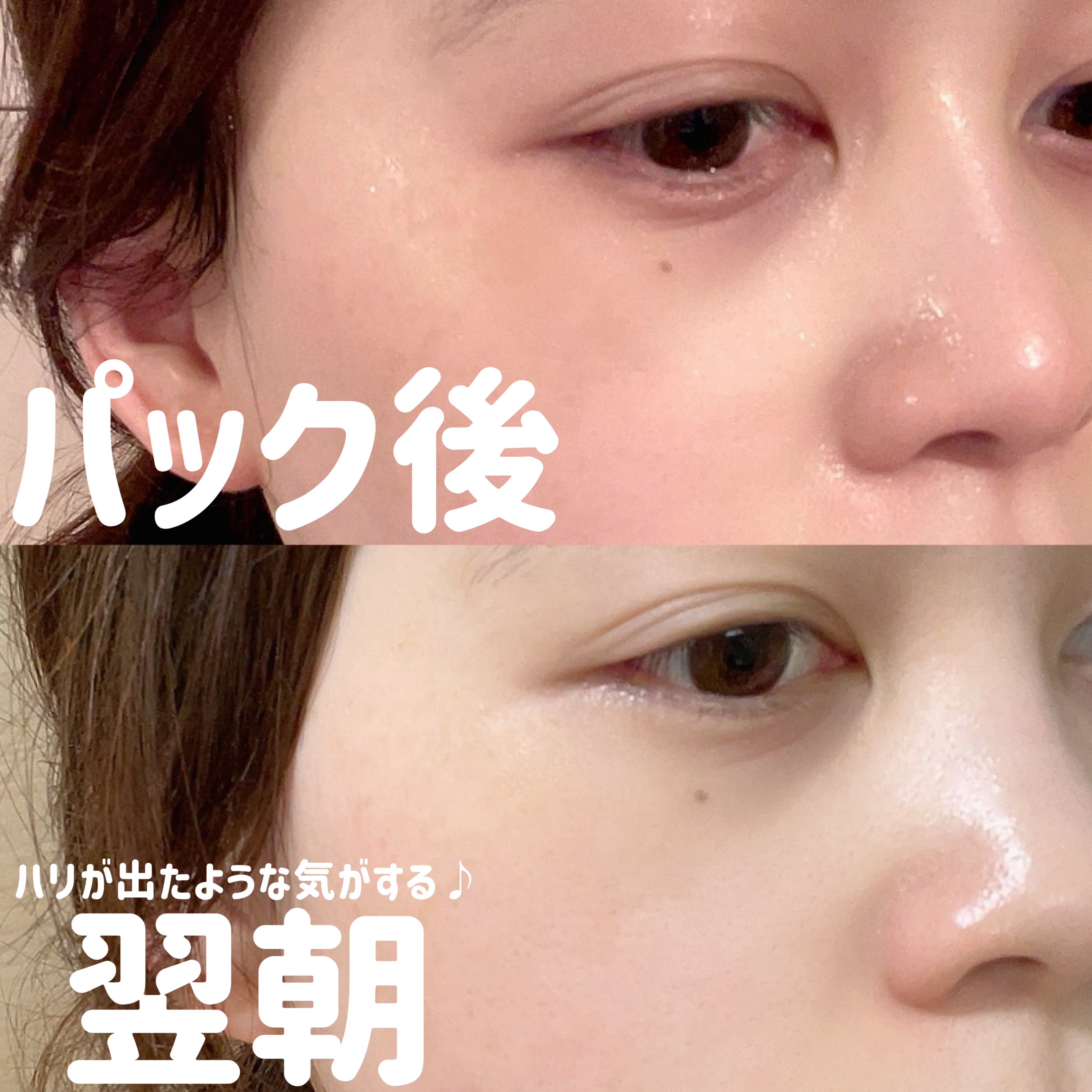 リードルS 100 2ステップマスク/VT/シートマスク・パックを使ったクチコミ（2枚目）