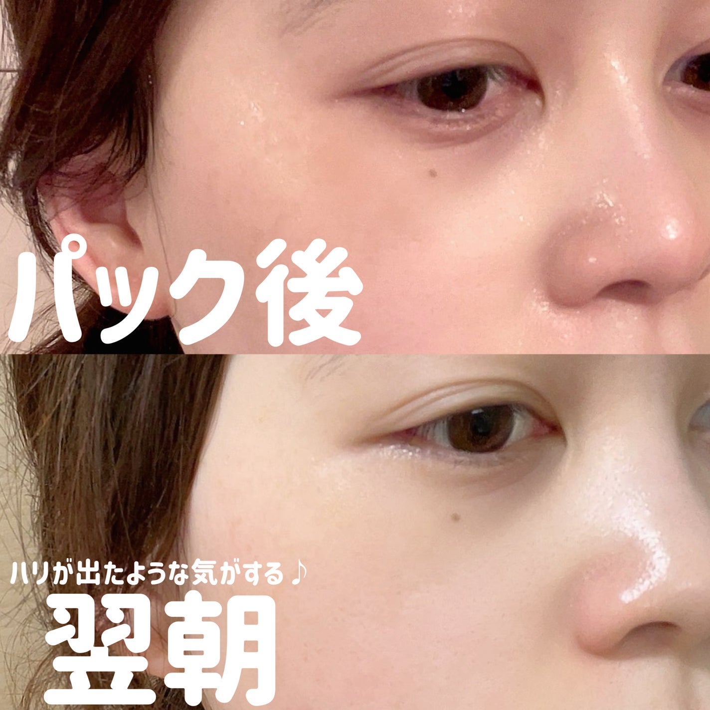 リードルS 100 2ステップマスク/VT/シートマスク・パックを使ったクチコミ(2枚目)