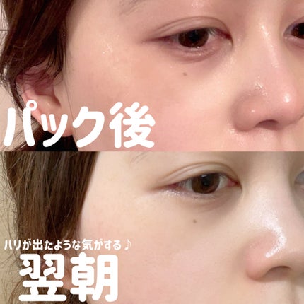 リードルS 100 2ステップマスク/VT/シートマスク・パックを使ったクチコミ(2枚目)