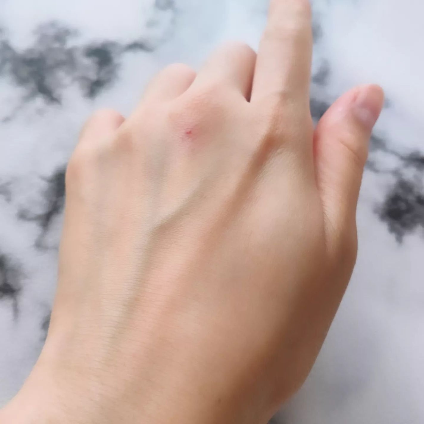 レッドスージングAIリペアクリーム/PHYSIOGEL/乳液を使ったクチコミ(5枚目)