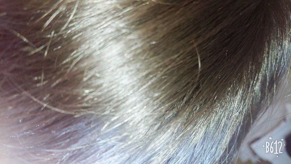 オキシドール(医薬品)/日本薬局方/その他を使ったクチコミ(3枚目)