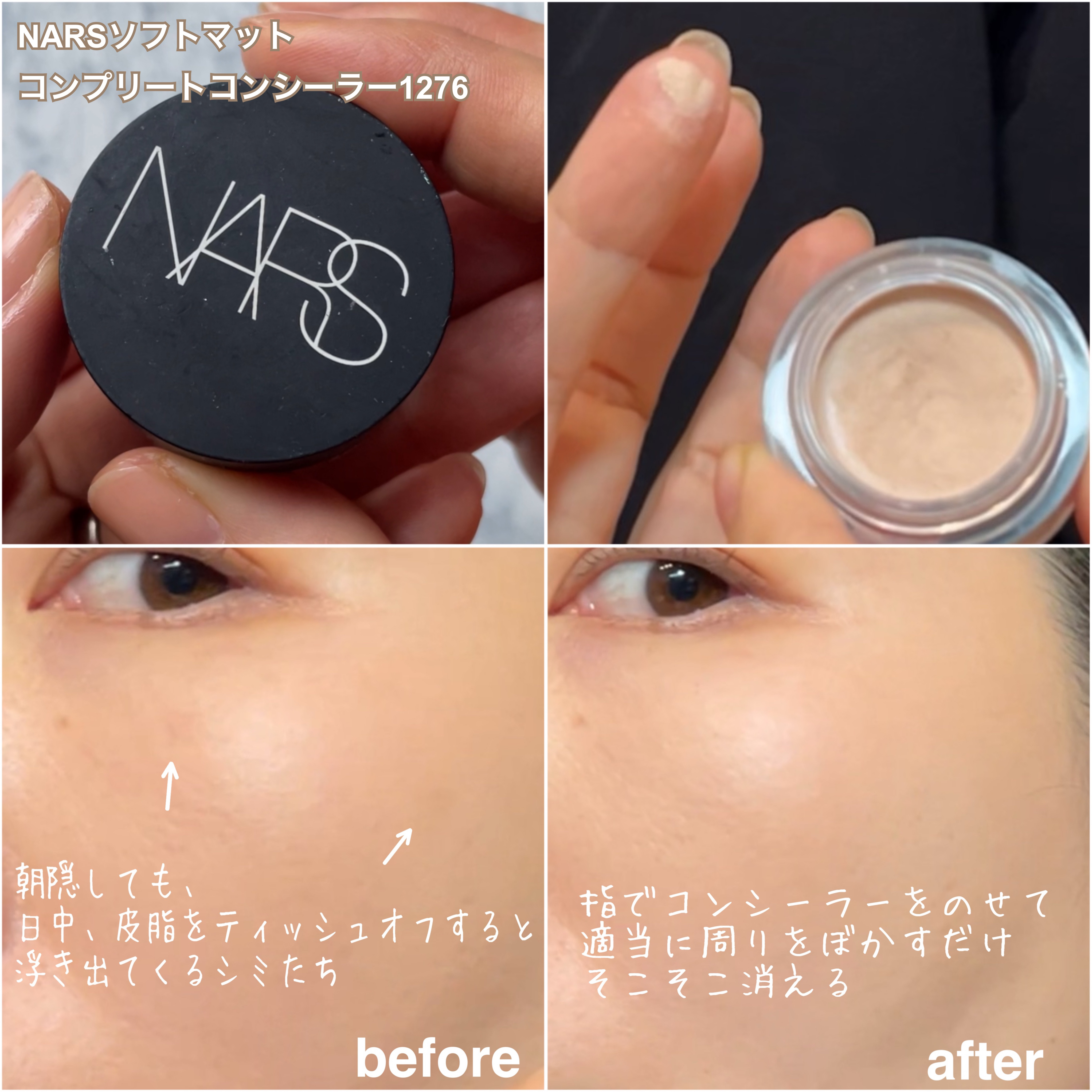 ソフトマットコンプリートコンシーラー 1276/NARS/クリームコンシーラーを使ったクチコミ（3枚目）
