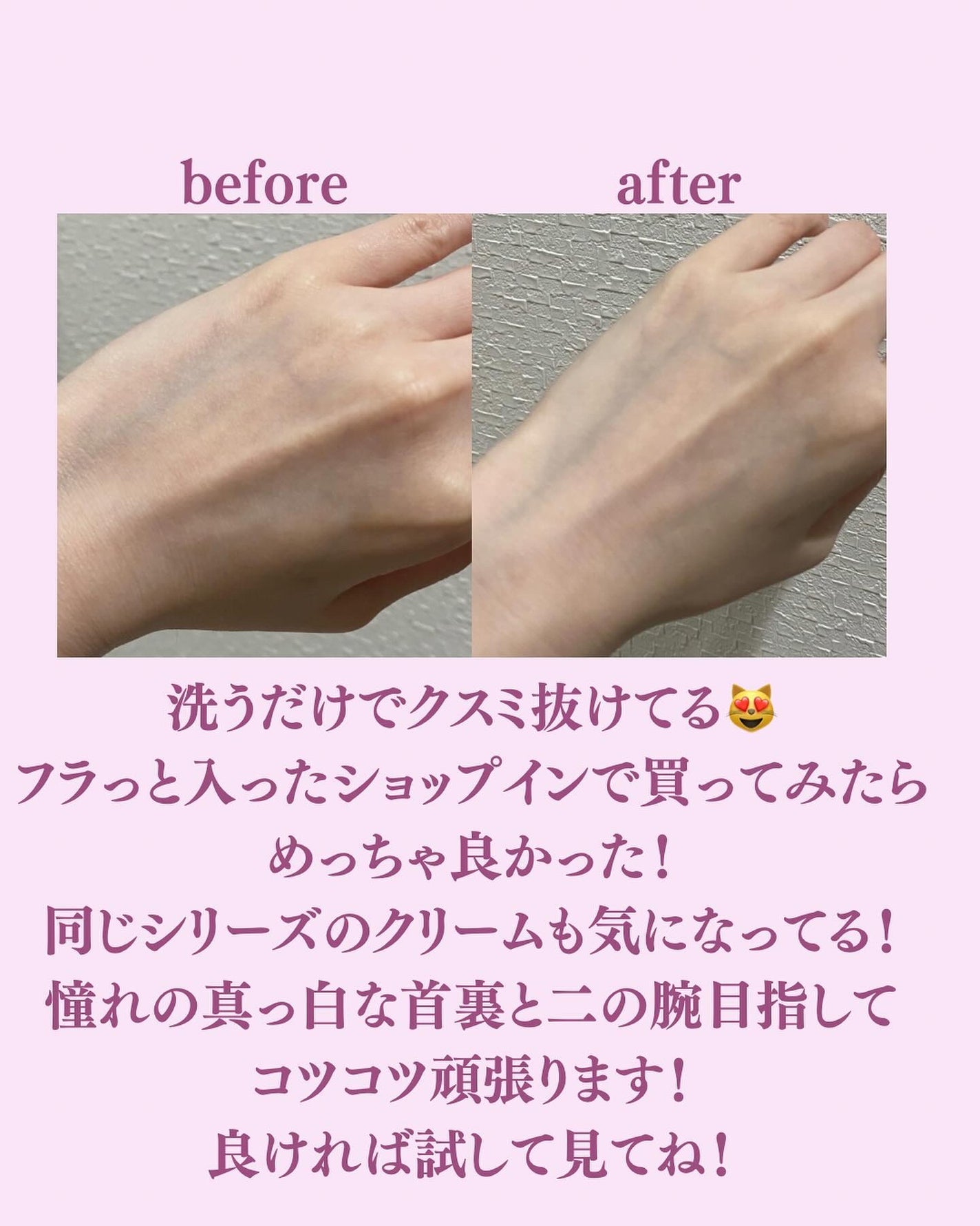 薬用ホワイトコンク ボディシャンプーC II/ホワイトコンク/ボディソープを使ったクチコミ(4枚目)