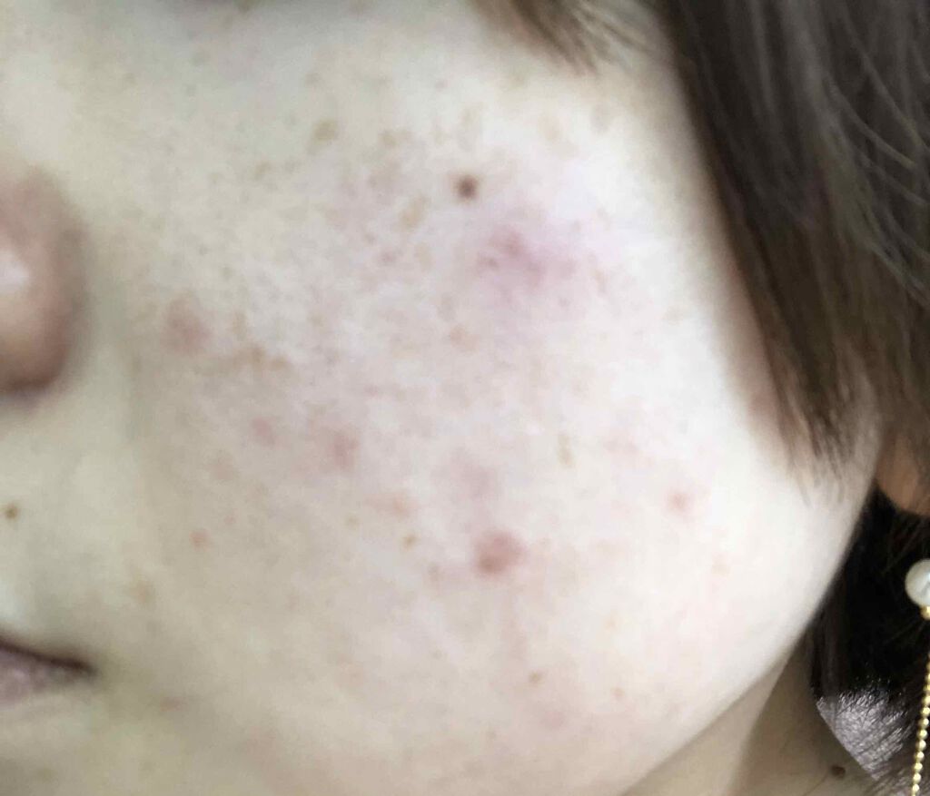 うるおい弱酸水(しっとり)/ビオレ/化粧水を使ったクチコミ（1枚目）