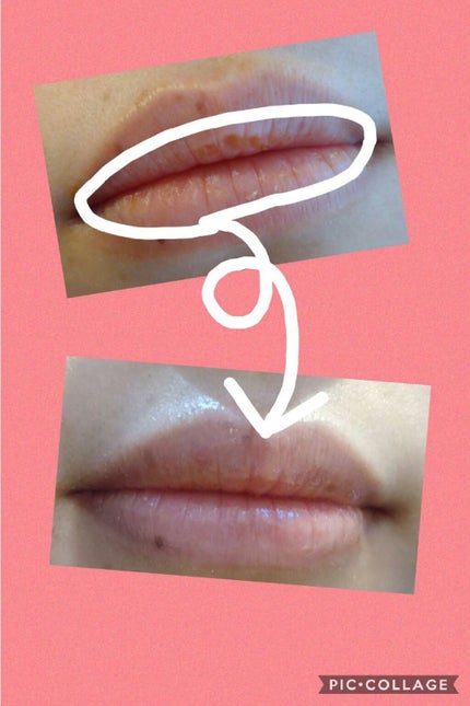 ãªãããã©ã³ããŒãšã¯ã¹ãã©ã»ã©ã /Borica/ãªãããã©ã³ããŒã䜿ã£ãã¯ãã³ãïŒ2æç®ïŒ