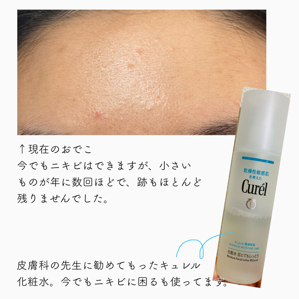 潤浸保湿 化粧水 III とてもしっとり/キュレル/化粧水を使ったクチコミ（3枚目）