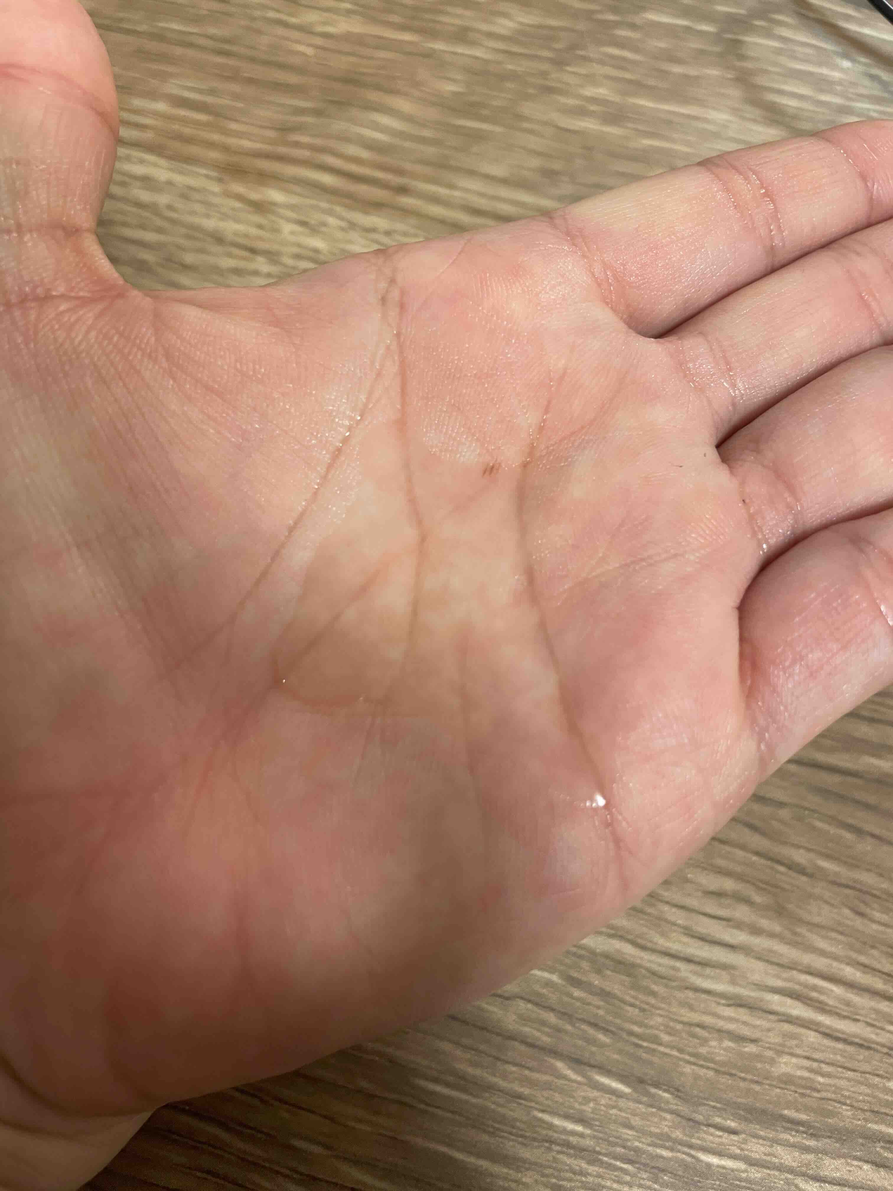 センテラ アンプル/SKIN1004/美容液を使ったクチコミ（2枚目）