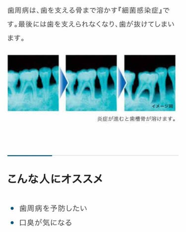 デンタルペースト/GUM/歯磨き粉を使ったクチコミ（4枚目）