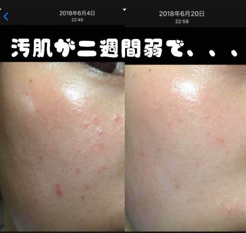 化粧水・敏感肌用・しっとりタイプ/無印良品/化粧水を使ったクチコミ(1枚目)