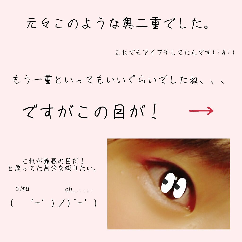 【旧品】オリシキ アイリッドスキンフィルム/D-UP/二重まぶた用アイテムを使ったクチコミ(2枚目)