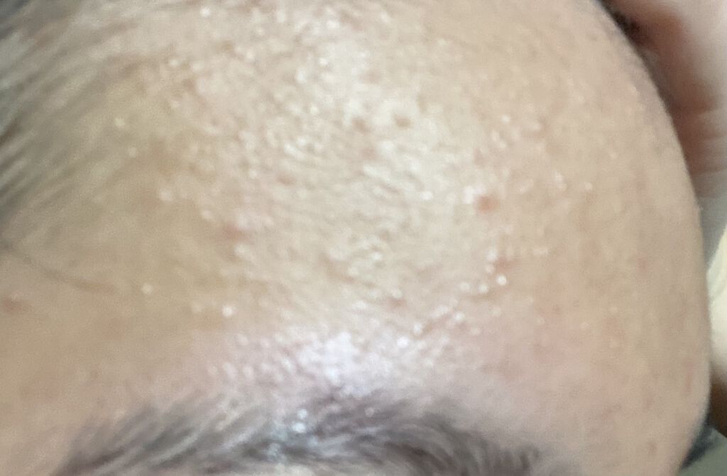 明色美顔水 薬用化粧水/美顔/化粧水を使ったクチコミ（2枚目）