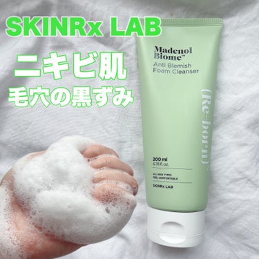 マデノルバイオームアンチブレミッシュフォームクレンザー/SKINRx LAB/洗顔フォームを使ったクチコミ（1枚目）