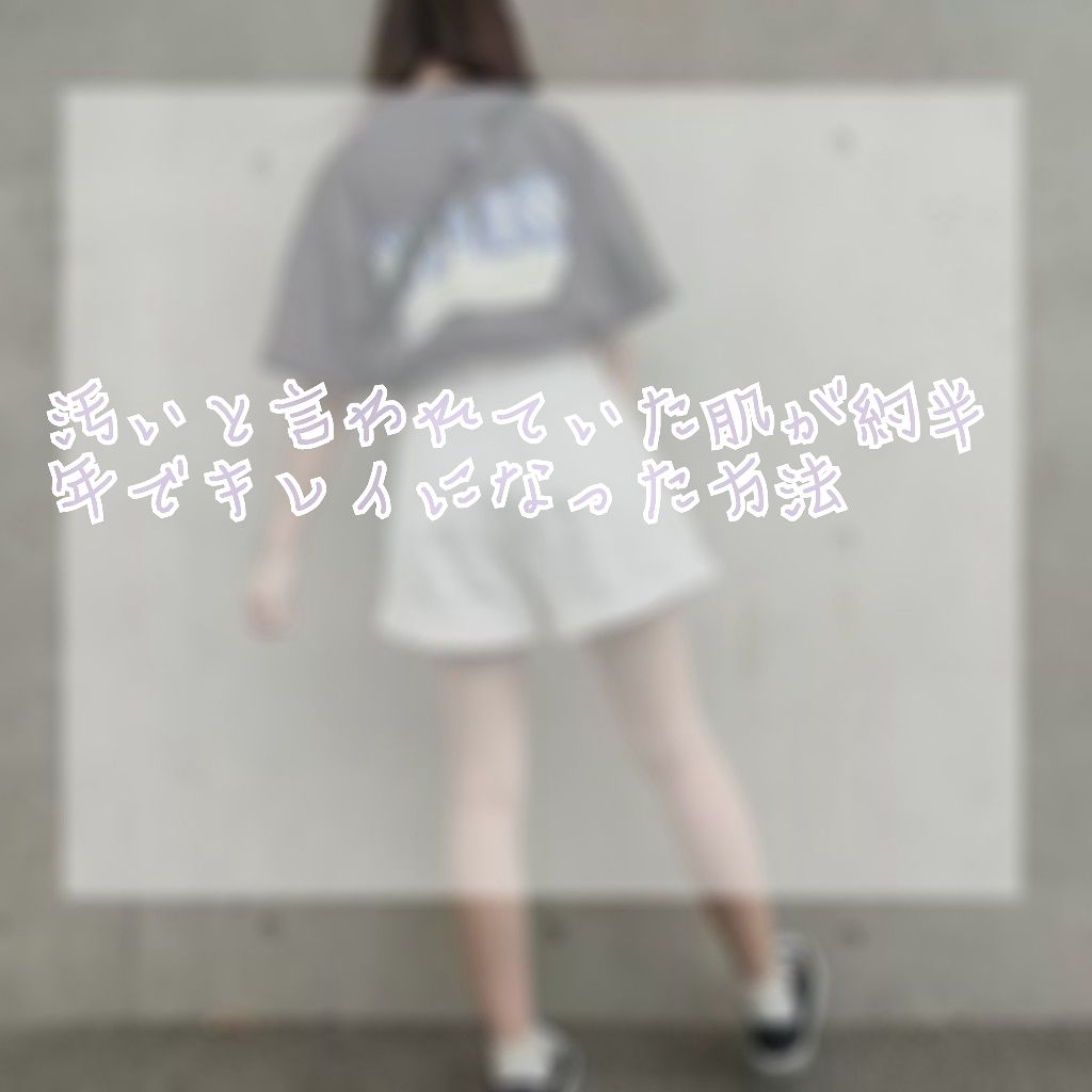 ハトムギ化粧水(ナチュリエ スキンコンディショナー R )/ナチュリエ/化粧水を使ったクチコミ（1枚目）