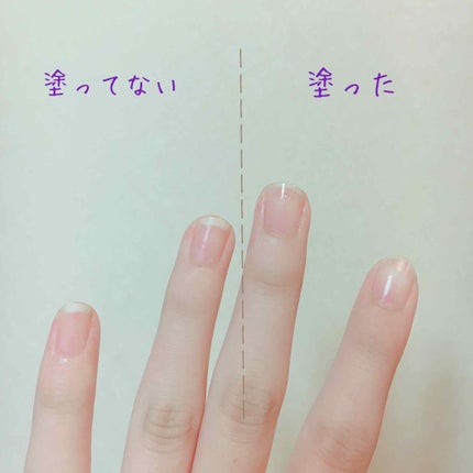 エテュセ クイックケアコート/ettusais/ネイルオイル・トリートメントを使ったクチコミ(3枚目)