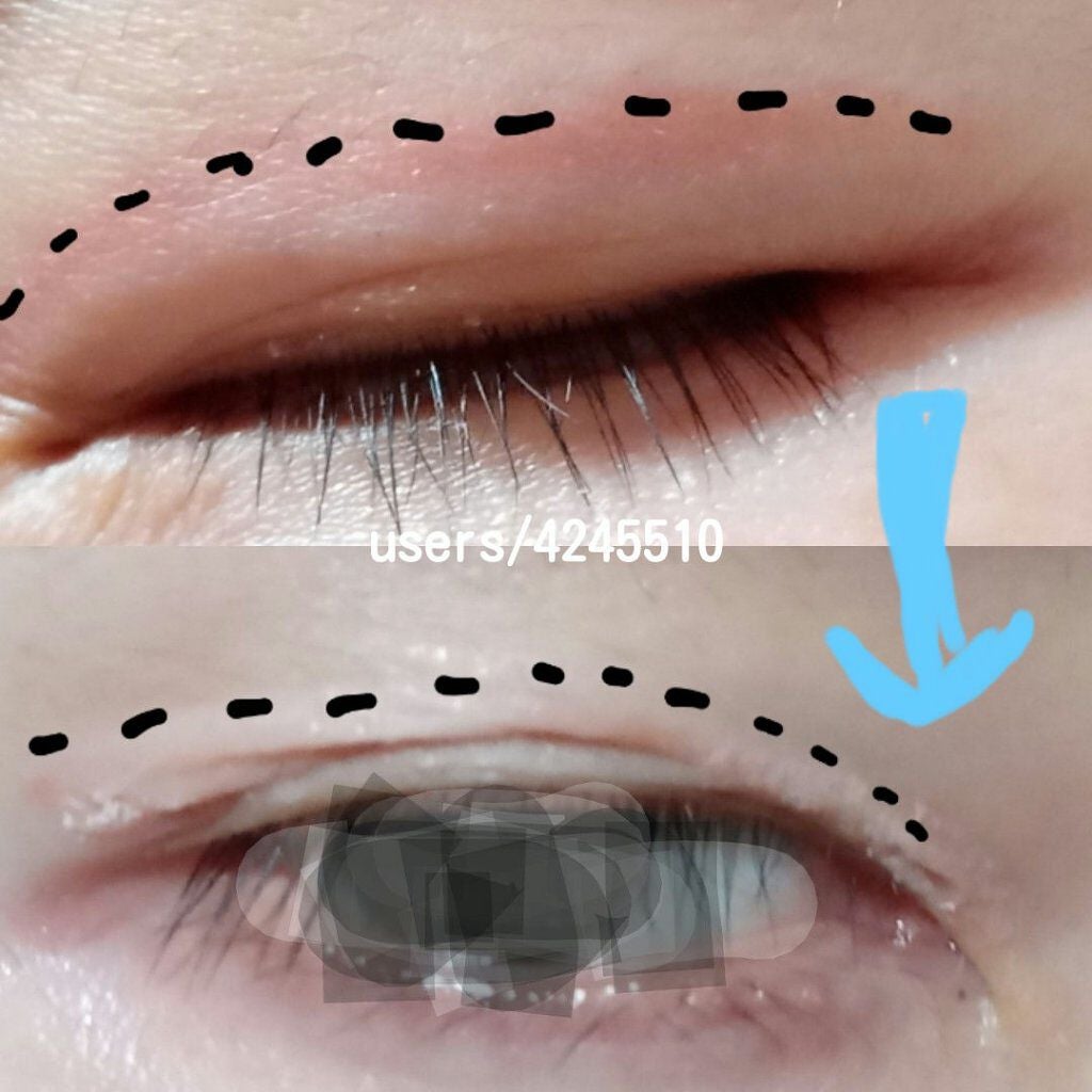 オリシキ アイリッドスキンフィルム /D-UP/二重まぶた用アイテムを使ったクチコミ(4枚目)