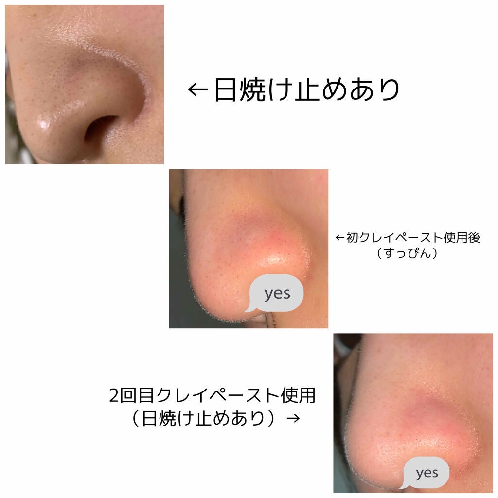 グリーンクレイペースト/ARGITAL/洗い流すパック・マスクを使ったクチコミ(3枚目)