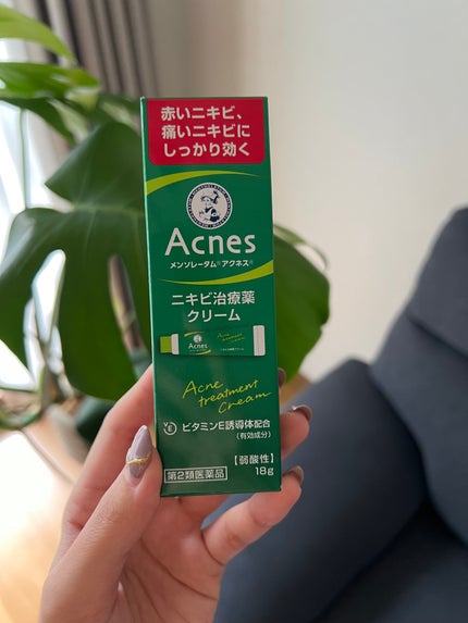 ニキビ治療薬(医薬品)/メンソレータム アクネス/その他を使ったクチコミ(1枚目)