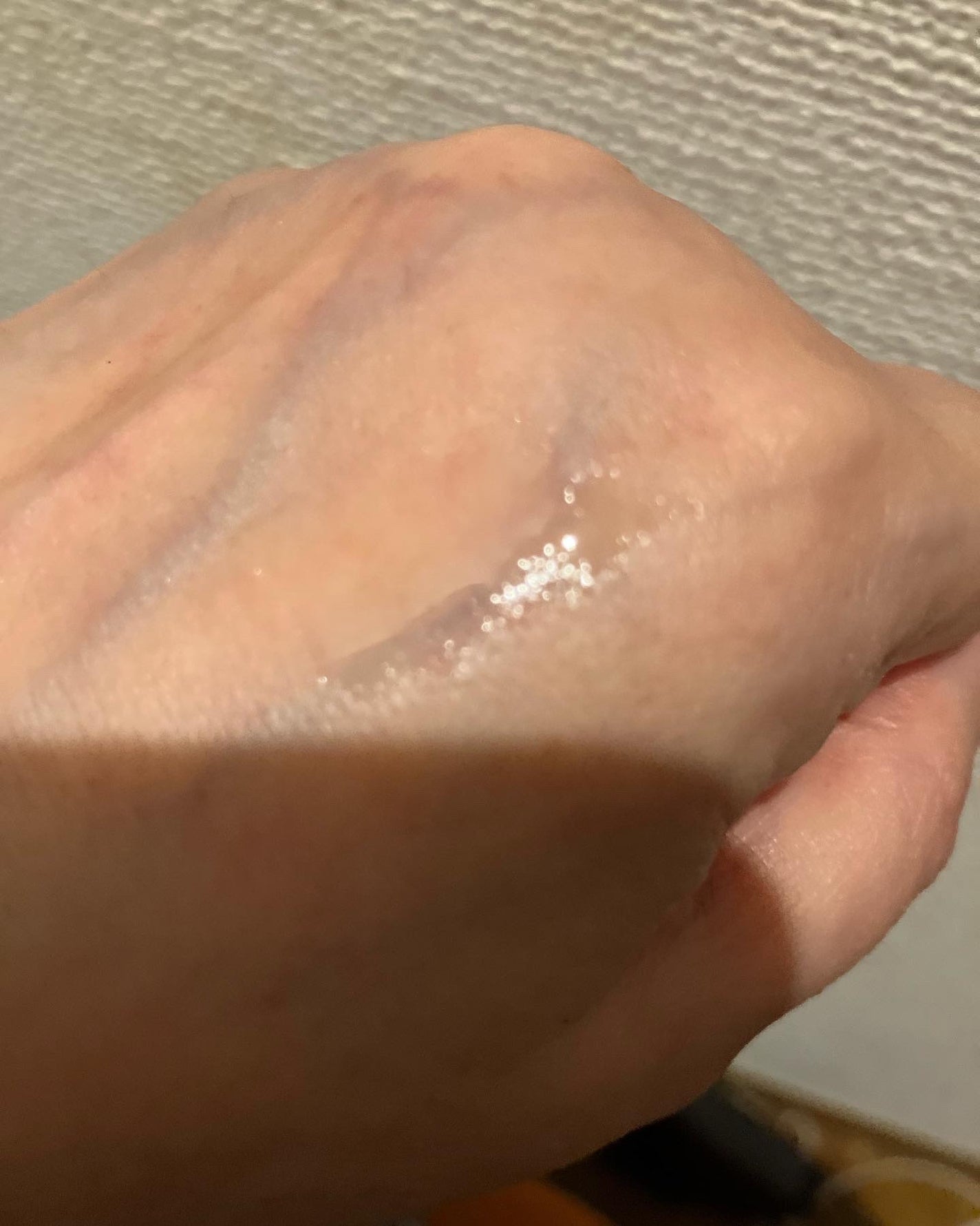 バイオイル/バイオイル/フェイスオイルを使ったクチコミ(4枚目)