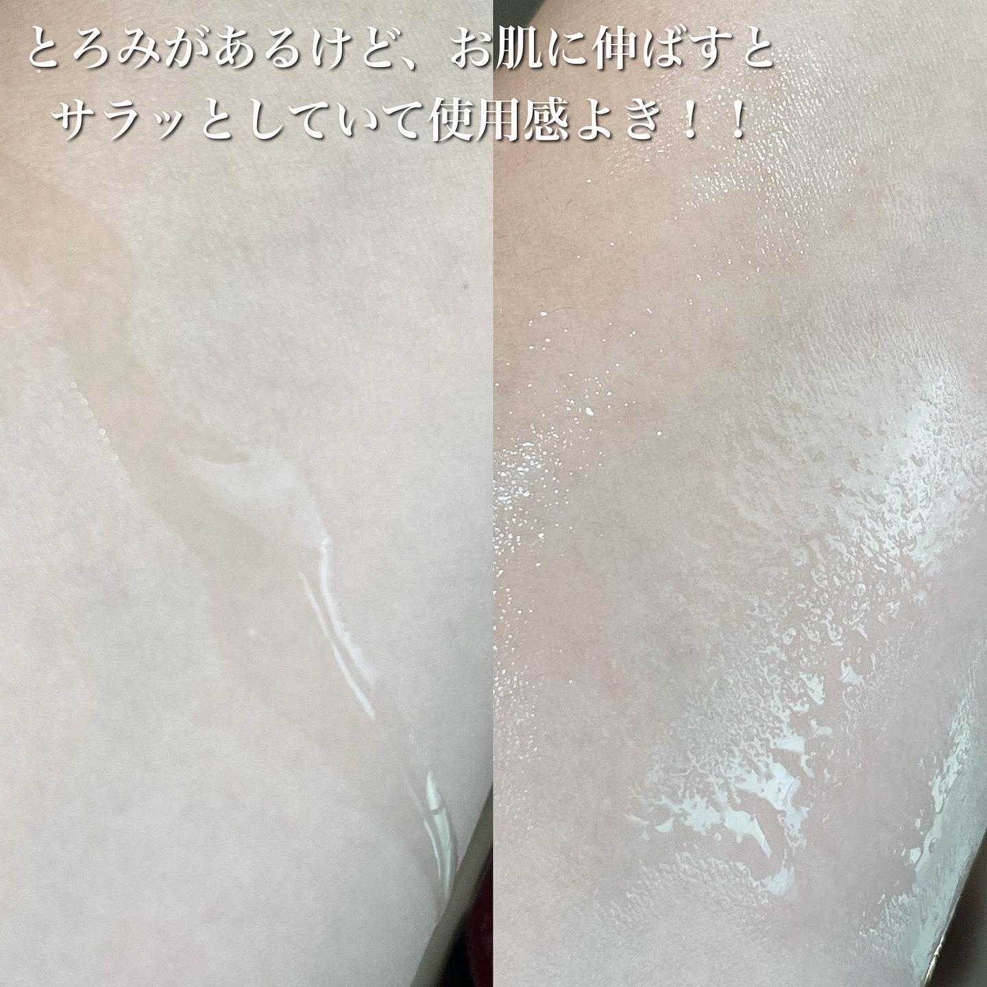 AZアゼライン酸15セラム/コスデバハ/美容液を使ったクチコミ（3枚目）