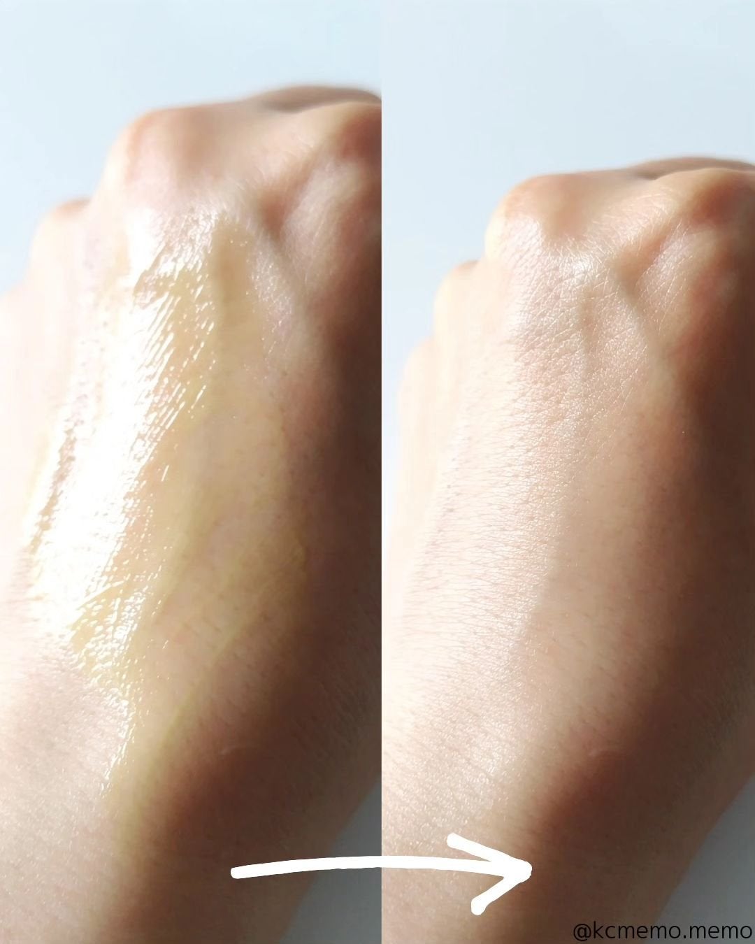 THE ビタA レチノールショット タイトニングセラム /celimax/美容液を使ったクチコミ(8枚目)