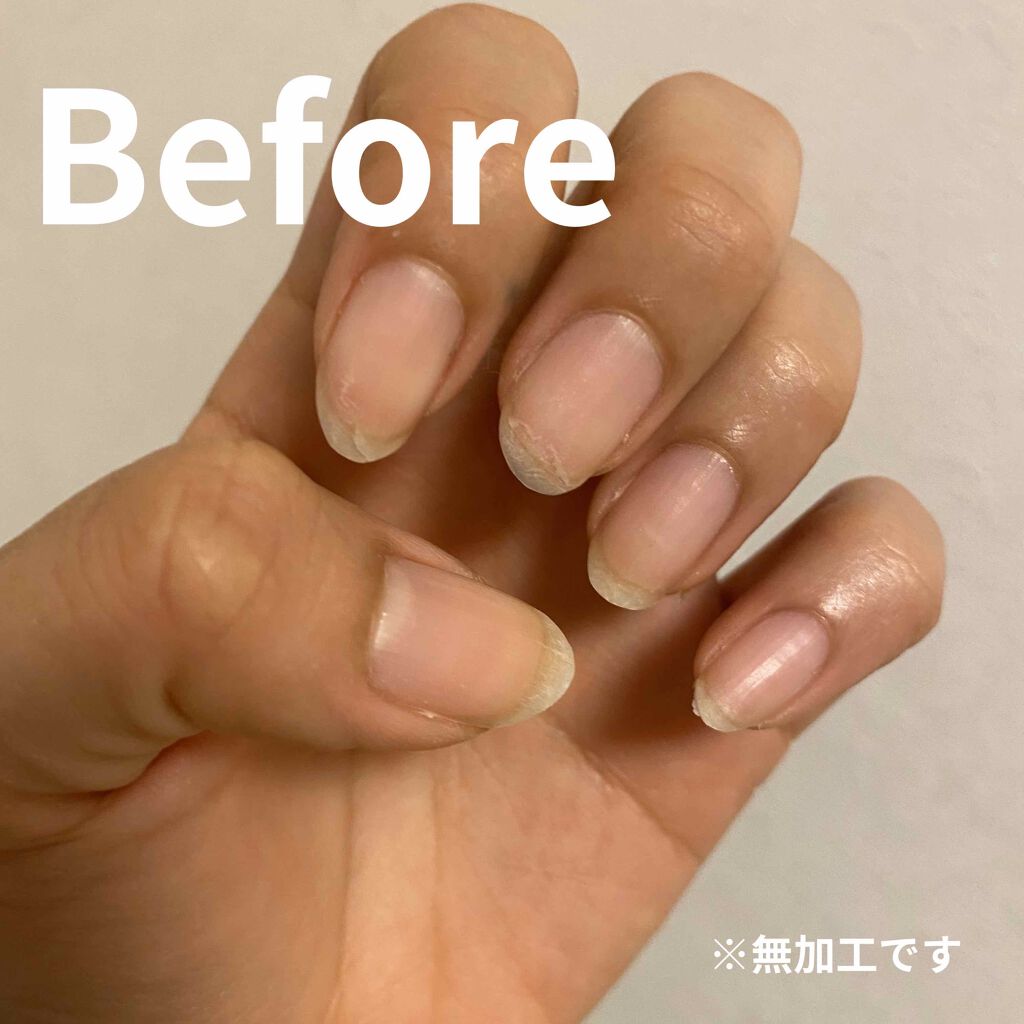 キューティクルリムーブオイル N/ネイルネイル/ネイルオイル・トリートメントを使ったクチコミ（3枚目）
