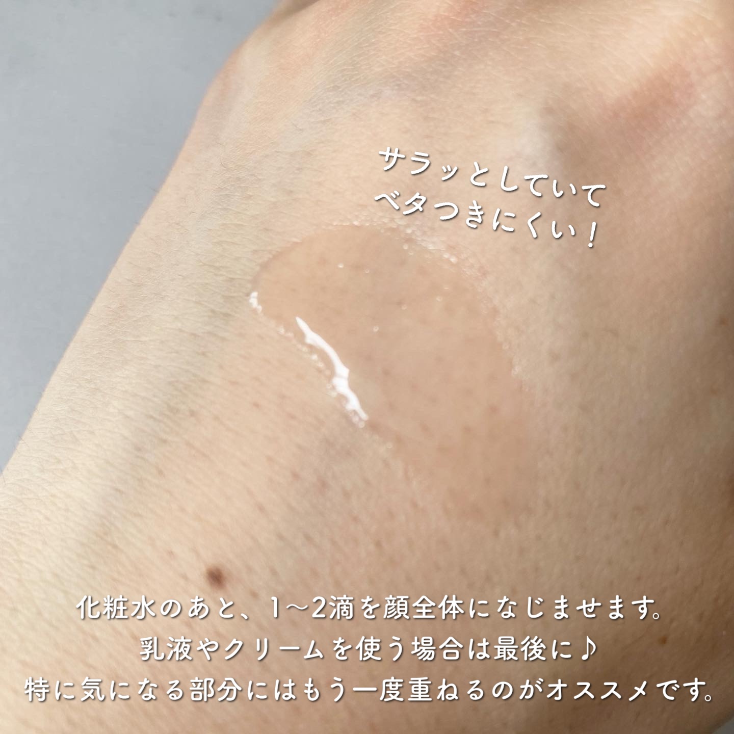 バイオイル/バイオイル/フェイスオイルを使ったクチコミ（2枚目）