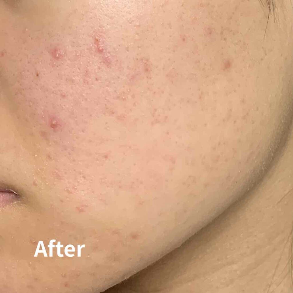 白色ワセリン(医薬品)/健栄製薬/その他を使ったクチコミ(3枚目)