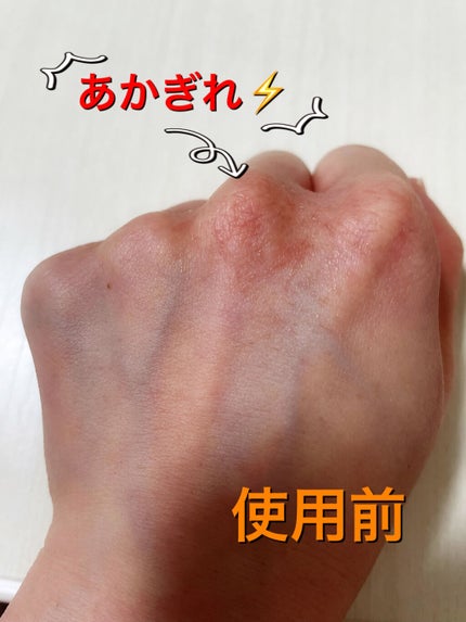 ユースキン/ユースキン/ボディクリームを使ったクチコミ(3枚目)