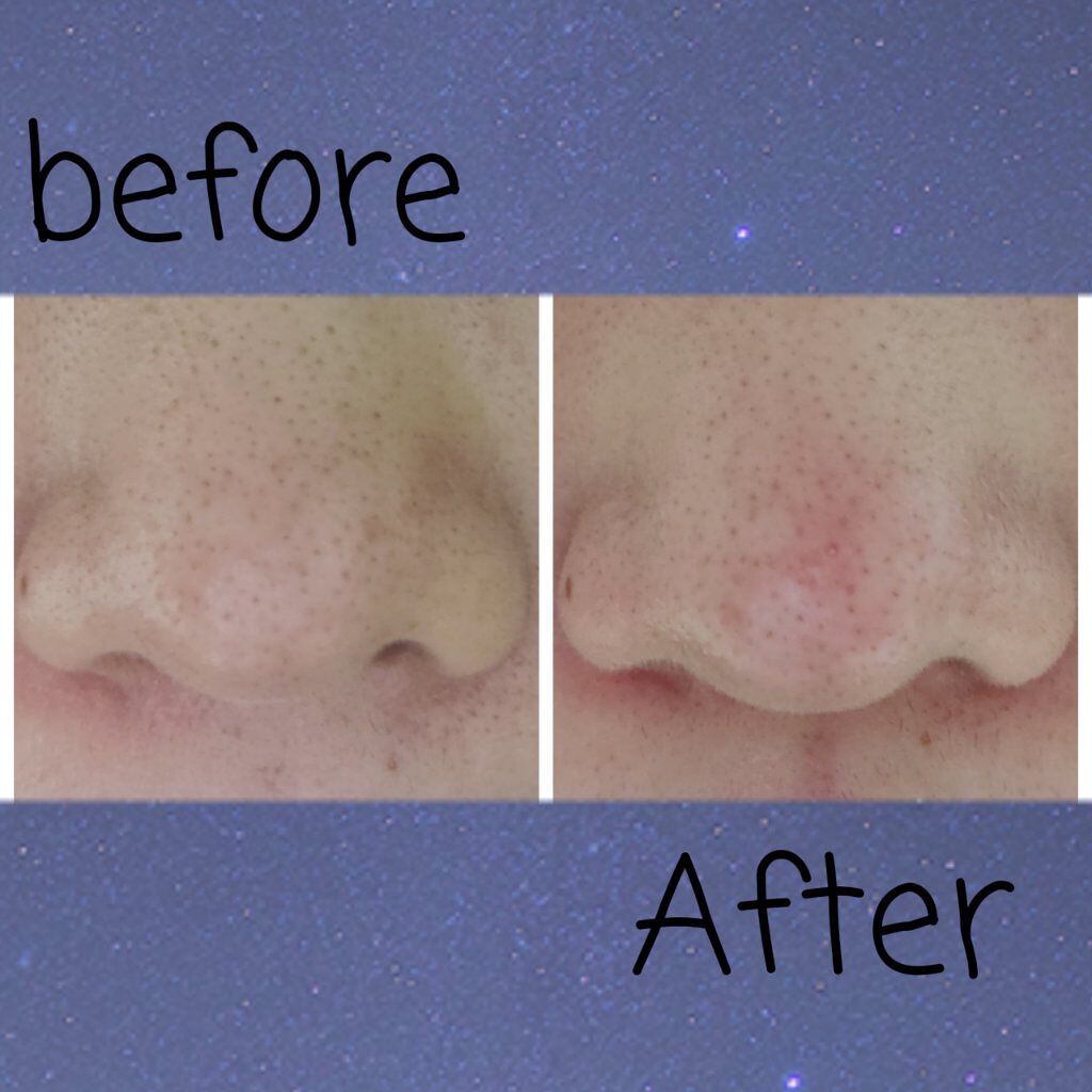 デュオ ザ クレンジングバーム ブラック/DUO/クレンジングバームを使ったクチコミ（3枚目）