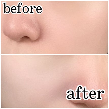 薬用ホワイトコンク ホワイトニングCC CII/ホワイトコンク/ボディクリームを使ったクチコミ(5枚目)