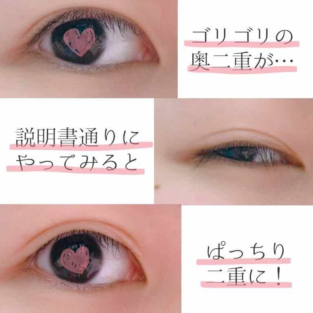 ハイブリッドフィルム/アイトーク/二重まぶた用アイテムを使ったクチコミ（2枚目）