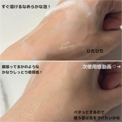 吸着泡パック化粧液 M(しっとり)/MoccHi SKIN/化粧水を使ったクチコミ(4枚目)