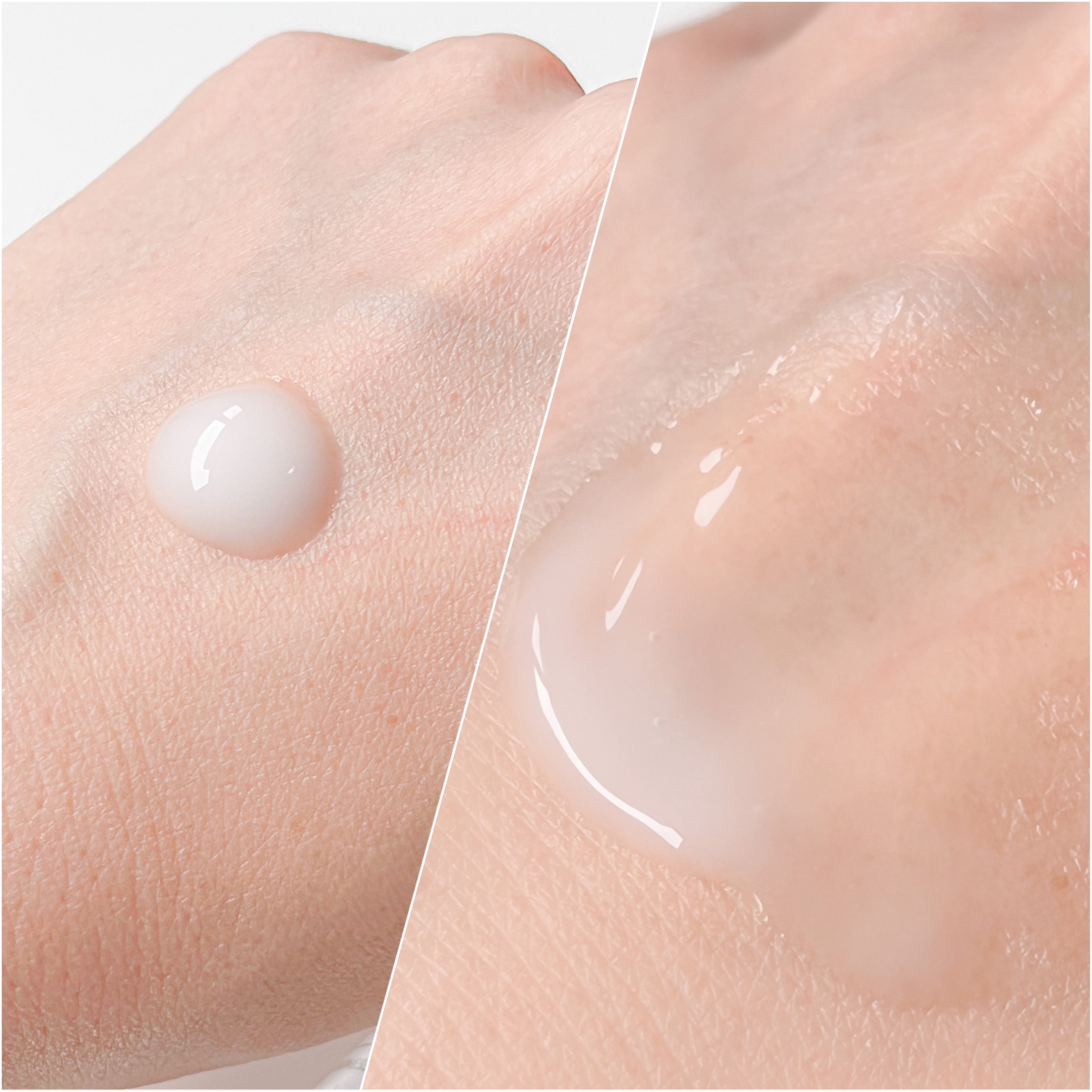 リードルショット300/VT/美容液を使ったクチコミ（3枚目）