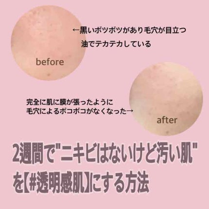 ハトムギ化粧水(ナチュリエ スキンコンディショナー R )/ナチュリエ/化粧水を使ったクチコミ(1枚目)