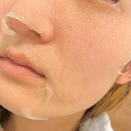 ダーマレーザースーパーVC100マスク/クオリティファースト/シートマスク・パックを使ったクチコミ(5枚目)