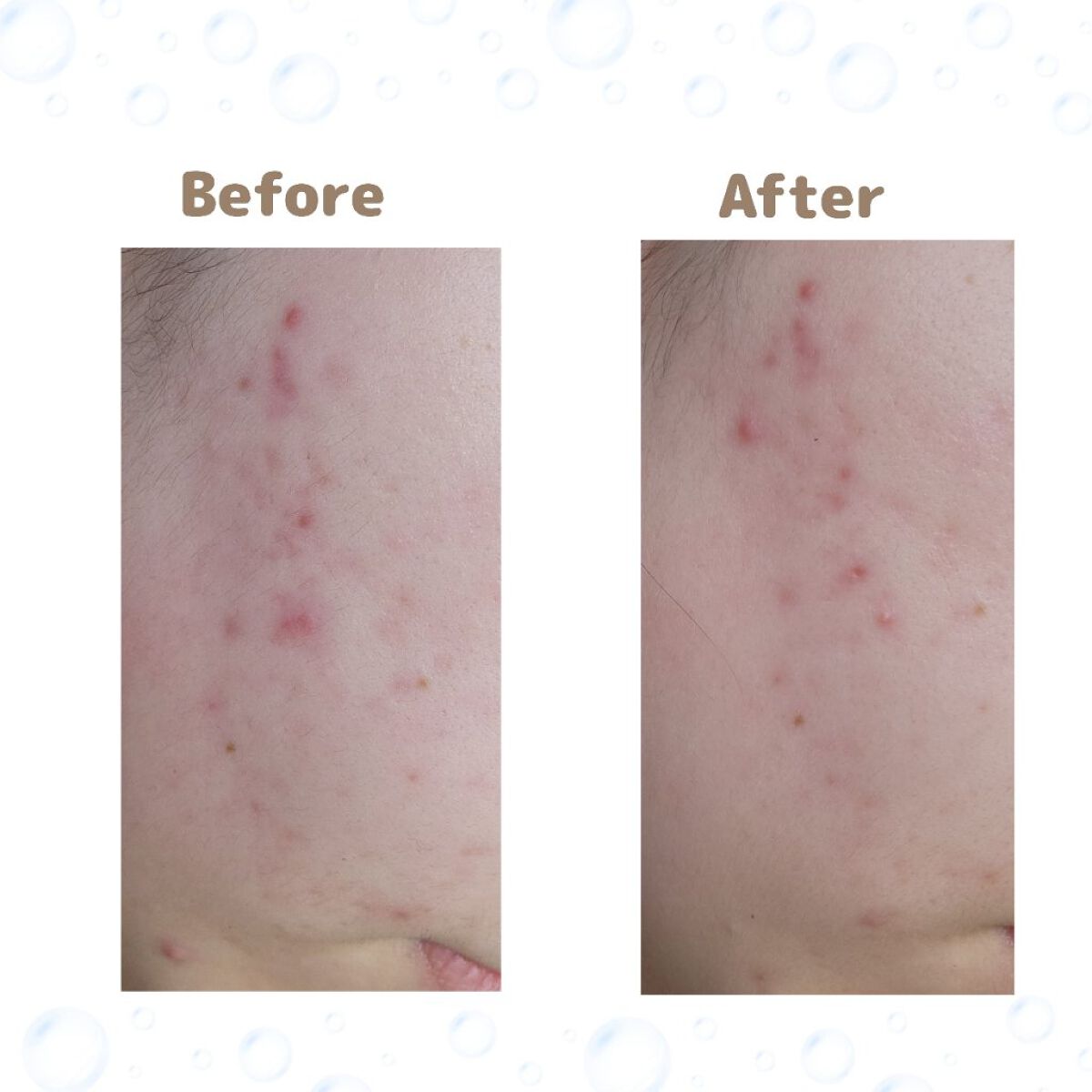 ツボクサ化粧水/ONE THING/化粧水を使ったクチコミ（2枚目）