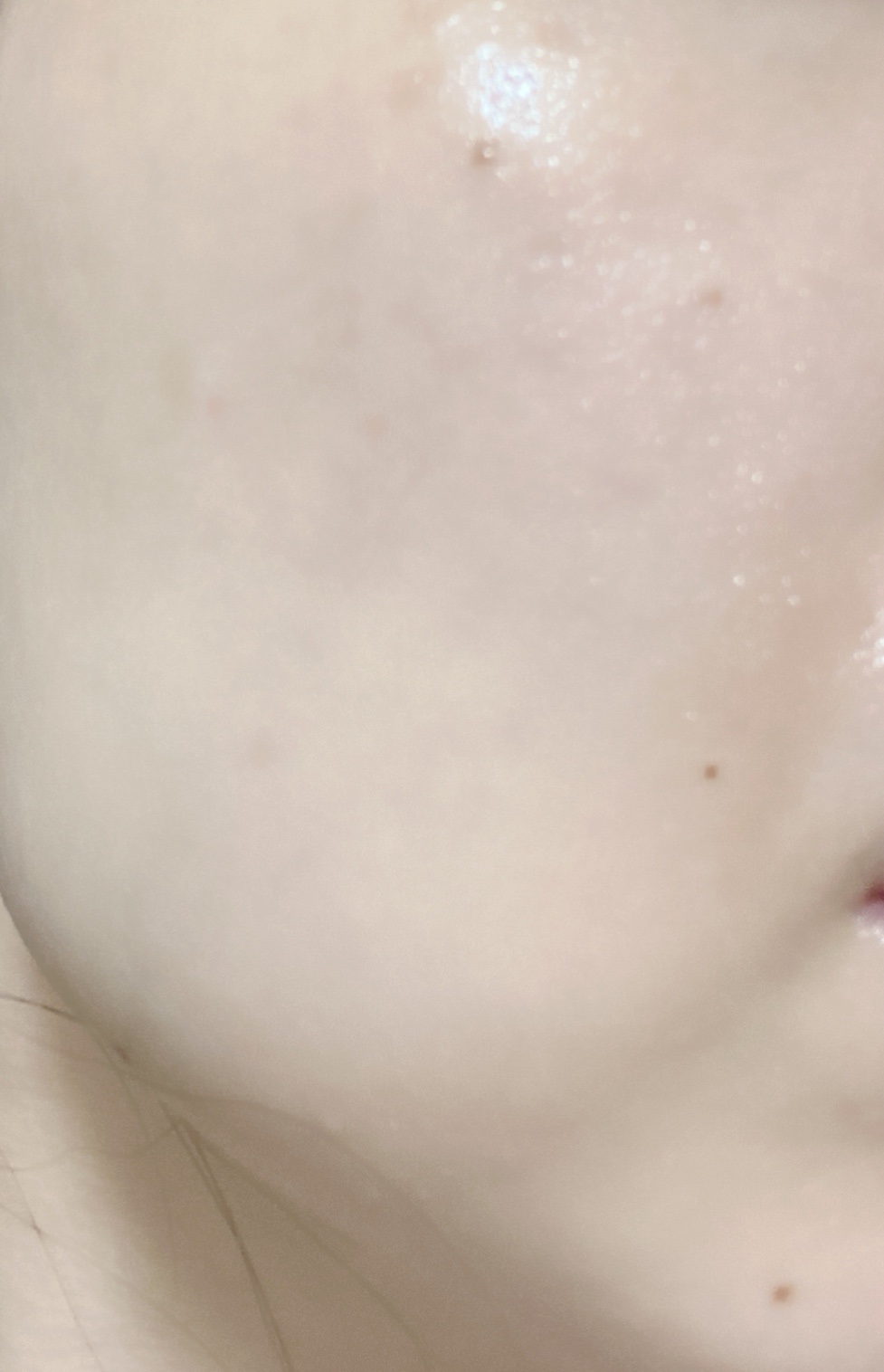 セルフホワイトニング ミッション/ALBION/美容液を使ったクチコミ（1枚目）