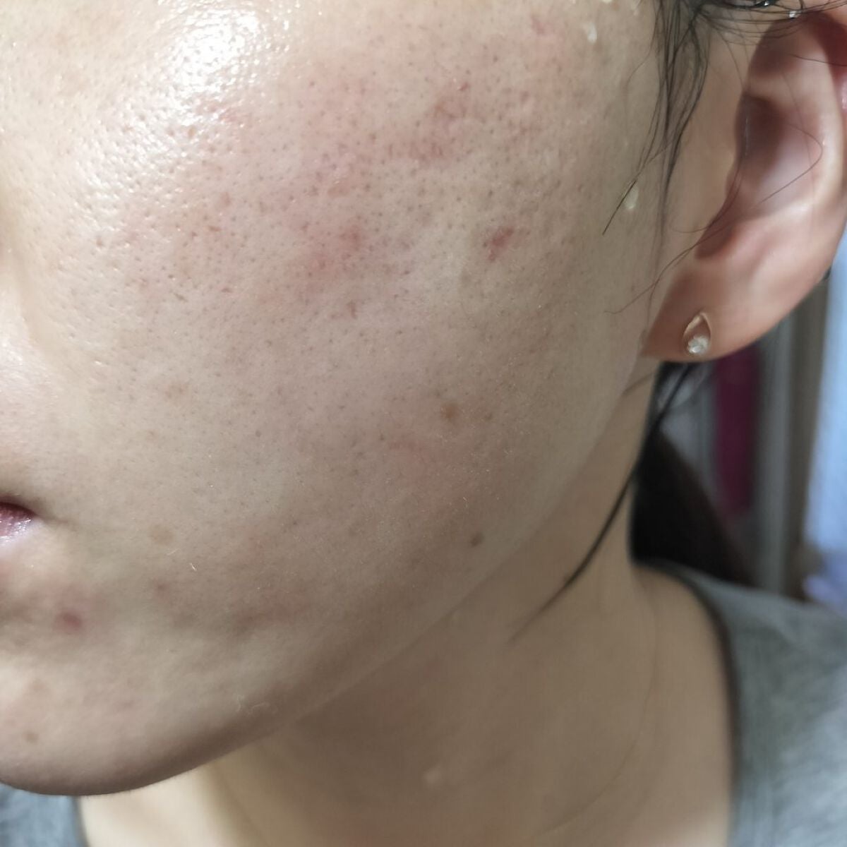 miina@汚肌工事録⚠️ on LIPS 「9/25の#汚肌工事録いつも、ありがとう😆/土日であやりちゃん..」(2枚目)