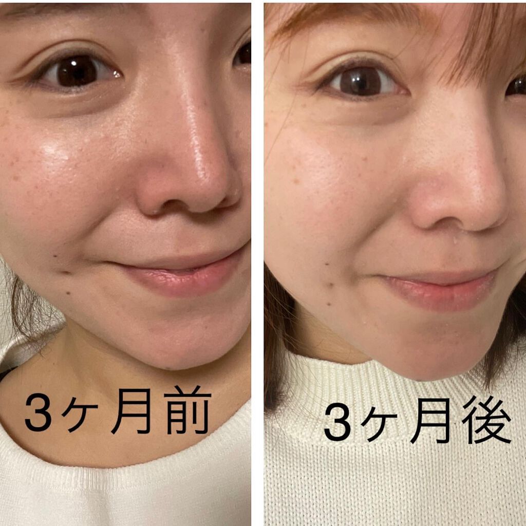 なぁな on LIPS 「肌をリセット🤍✨\\凝縮の1滴//SOLVEナイトパールエッセ..」(5枚目)