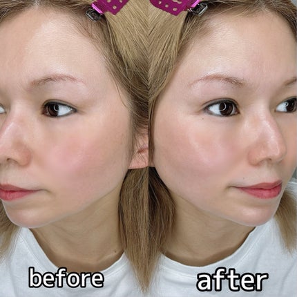 ダイヤリフト3000ショット/ECLIMOI/フェイスクリームを使ったクチコミ(5枚目)