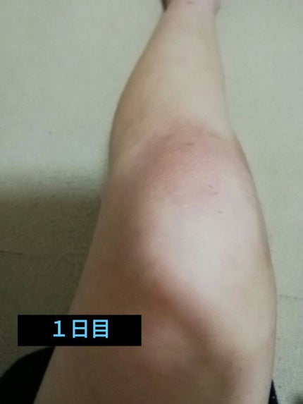 ニベアクリーム/ニベア/ボディクリームを使ったクチコミ(2枚目)