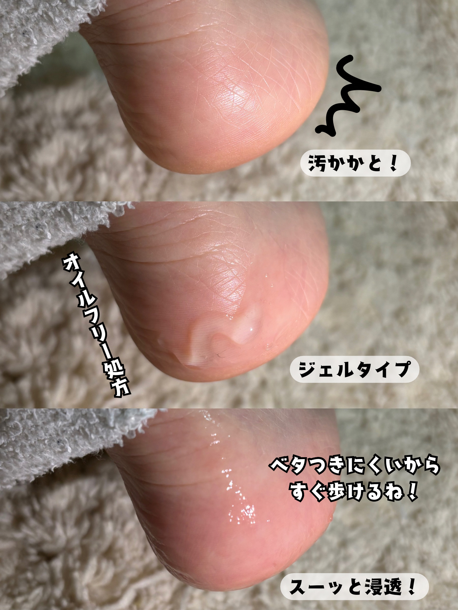 足小路麗子 薬用 フットケアジェル/ナリスアップ/レッグ・フットケアを使ったクチコミ（2枚目）