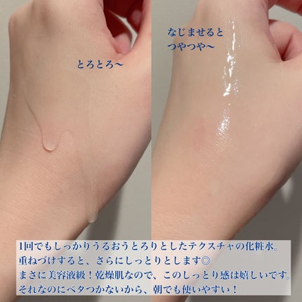 モイスチュアチャージローション/MUNOAGE(ミューノアージュ)/化粧水を使ったクチコミ(7枚目)