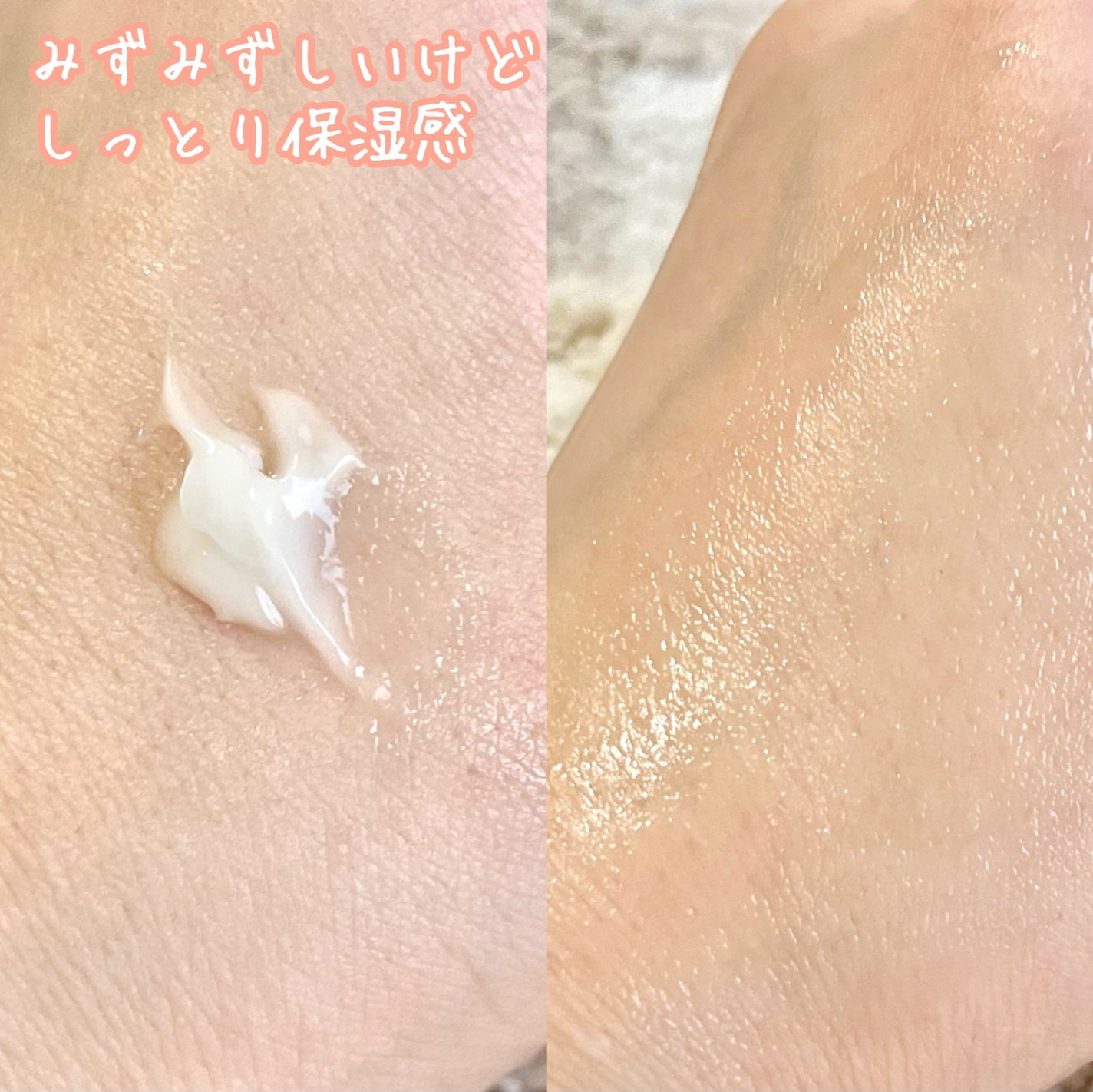 エイクリアスポットキュアパッチ/Dr.G/その他スキンケアを使ったクチコミ(3枚目)